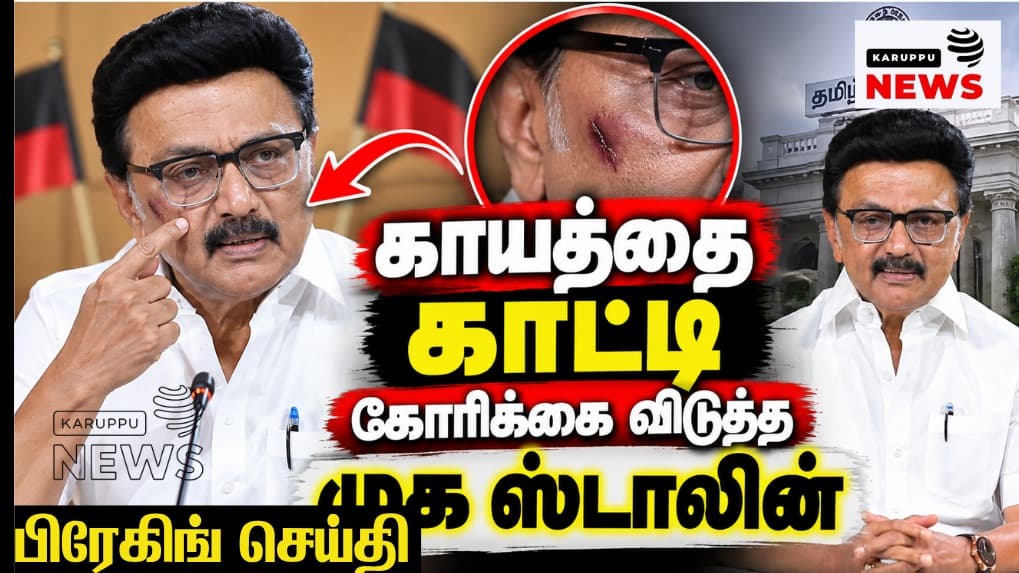 🔴 "மிசா தழும்பு" நாடகமும், துர்கா ஸ்டாலின் காலில் விழுந்த பரந்தாமனும் - திமுகவின் 'தியாக' முகமூடி கிழிவு!